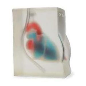 Cardiac Ultrasound Training Block (Transparent)