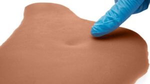 Ödempflaster gegen Dellenbildung – 6er-Packung