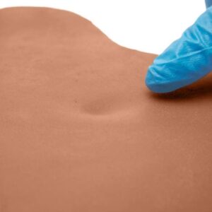 Pitting Edema Sticky Pads Mix Package