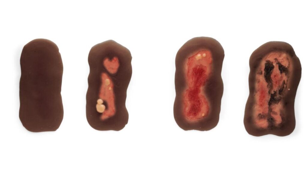 Sticky Burn Wound Kit - 12 PC Package