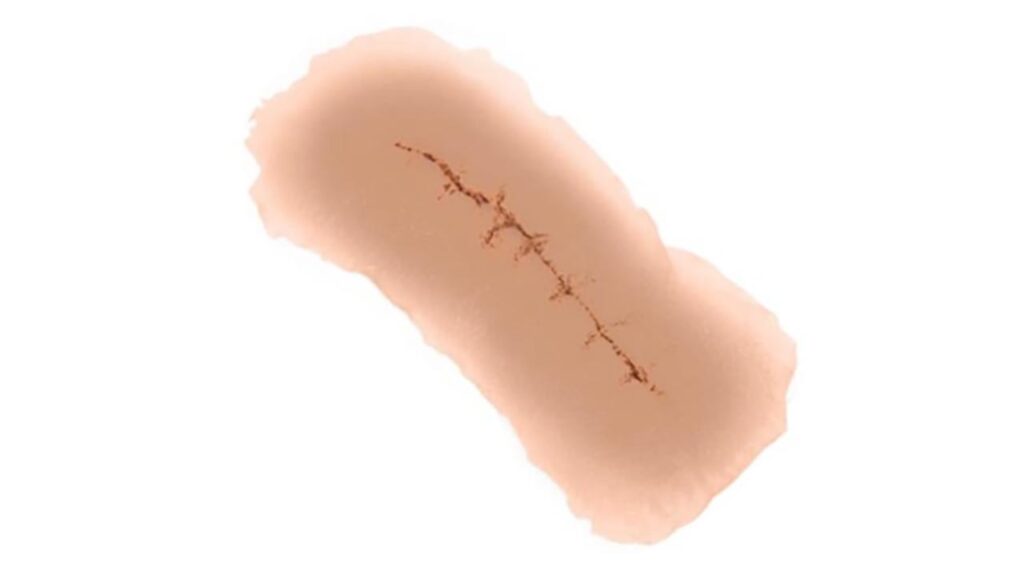 Sticky Wound Incision - 12 PC Mix Package