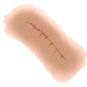 Sticky Wound Incision Mix Package