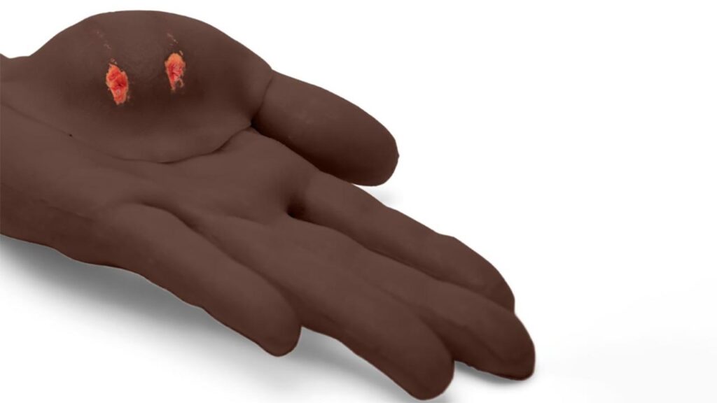 Sticky Wound Gunshot & Bite Wound - 6 PC Mix Package