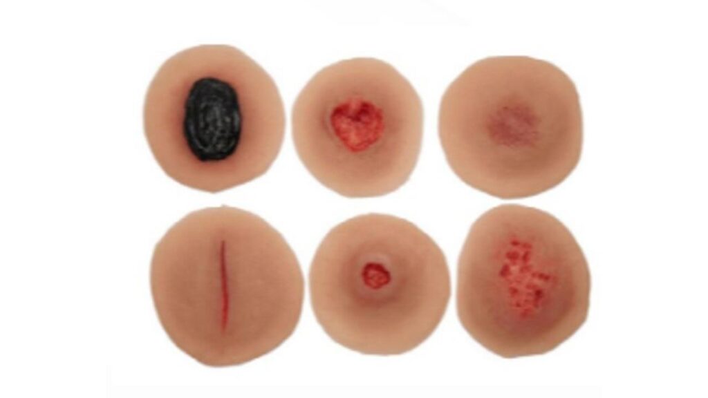 Sticky Wound Kits – 18 PC Mix Packages