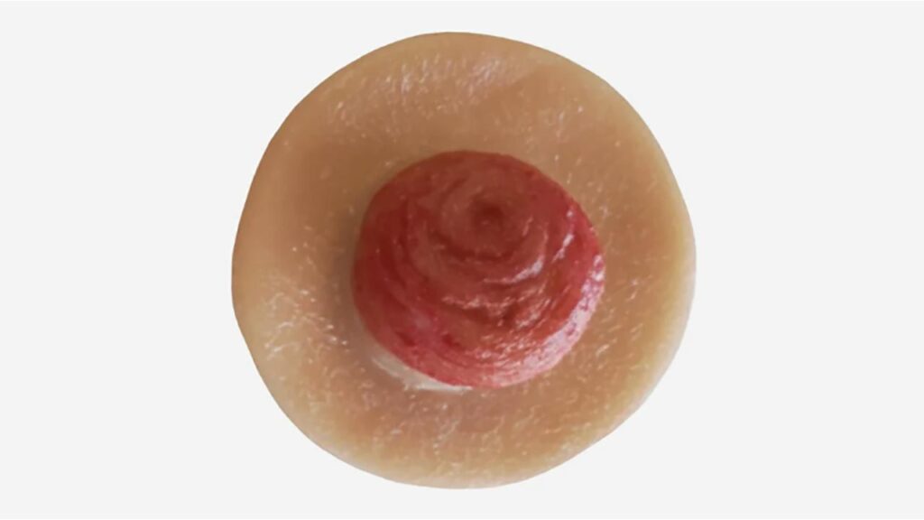 Sticky Artificial Stoma & Sticky Artificial Stoma with Bridge - 3 PC Mix Package