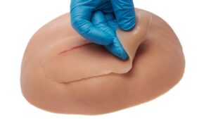 Kaiserschnitt, vaginale Hämorrhoiden & Dammschnitt & Vaginalhygiene - 9-teiliges Mix-Paket