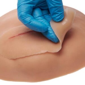 Caesarean Incision, Vaginal Hemorrhoid & Episiotomy & Vaginal Hygiene Mix Package