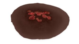 Hämatome, Hautrötungen und feine Hautausschläge, klebrige Wunden – 9-teiliges Mix-Packung