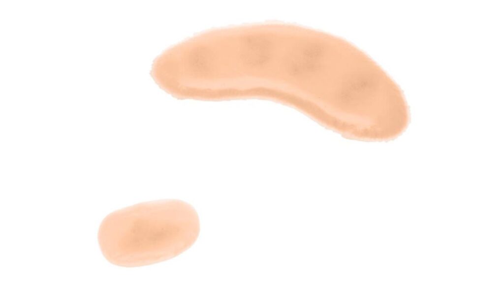 Sticky Wound, Ecchymosis Hand - 6 PC Mix Package